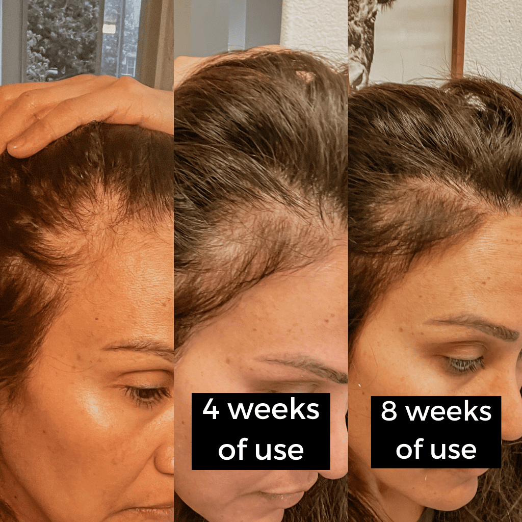 Juliart Hair Revitalizing Serum Before and After